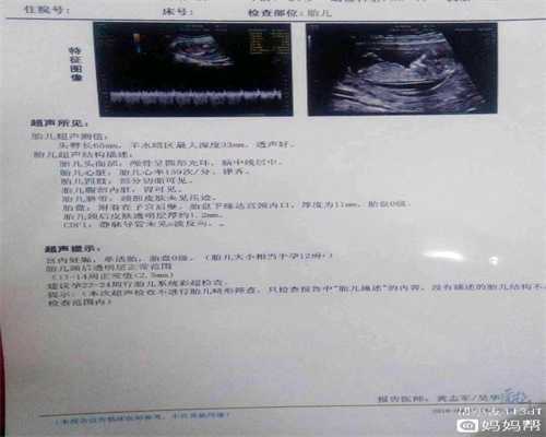 深圳人工受孕电话,孕期的这3种现象，是宝宝在通