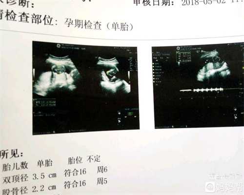 黄玉浩  刘保君,孕妇瑜伽孕7个月适合做的孕妇瑜
