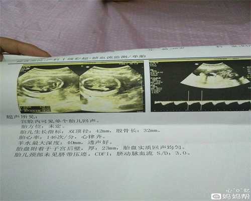 深圳嘉乐生殖医院,10大怀孕初期症状排行榜，7种