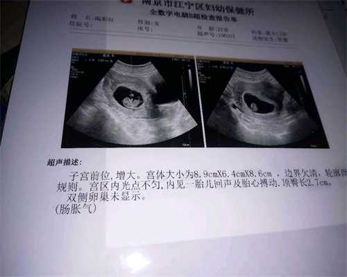 黄玉浩  刘保君,百度泰东方国际医旅,孕期前三个