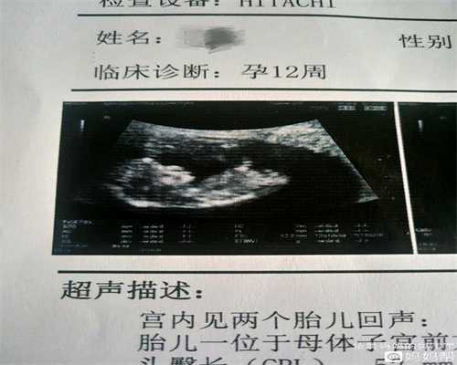 深圳助孕机构,双十一，孕期的妈妈们剁手了吗