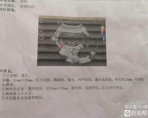 深圳助孕包成功,怀孕16周后, 孕妈要坚持做这件事