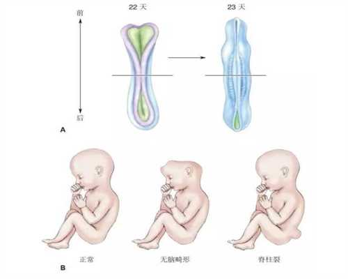 深圳2020年代孕孩子_不出血是不是没有生化