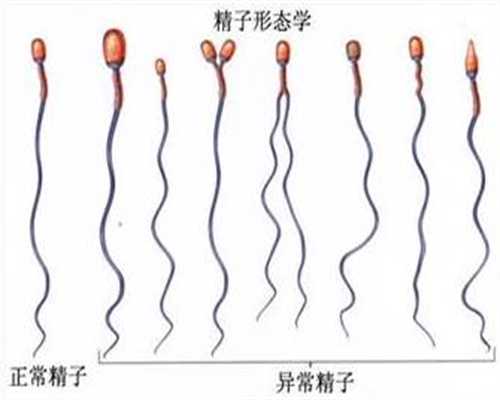 深圳代怀孕在线咨询_哺乳期怀孕乳汁变化是怎样